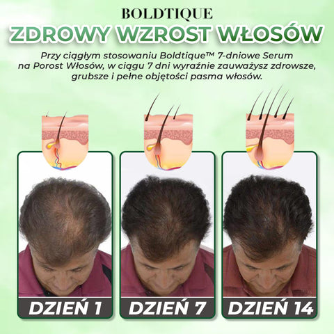 Boldtique™ 7-dniowe Serum na Porost Włosów