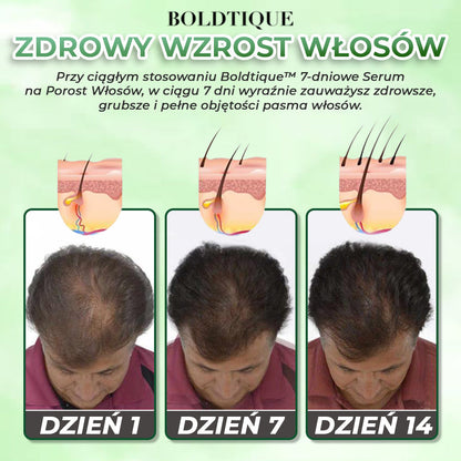 Zdobądź 2x Boldtique™ 7-dniowe Serum na Porost Włosów za 75% zniżki