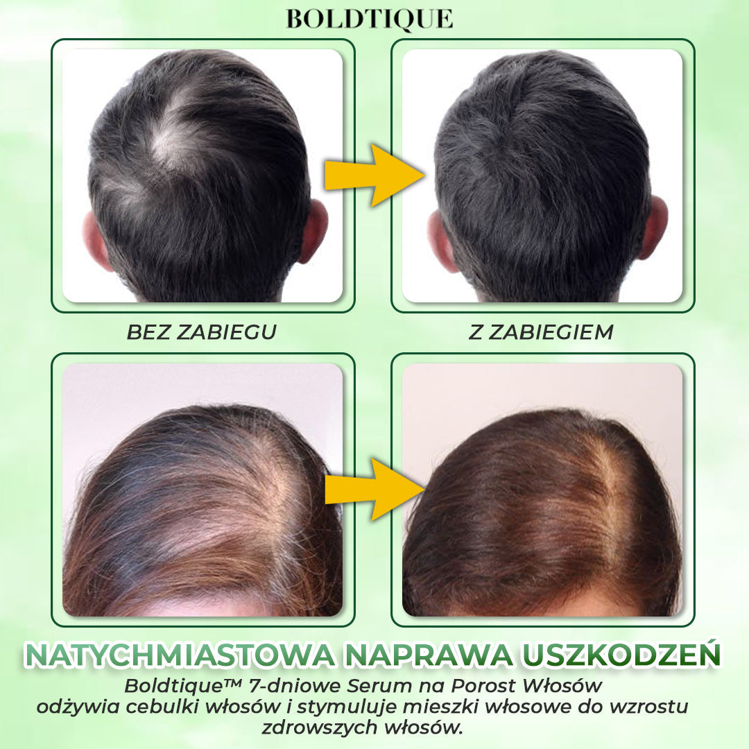 Zdobądź 3x Boldtique™ 7-dniowe Serum na Porost Włosów za 70% zniżki