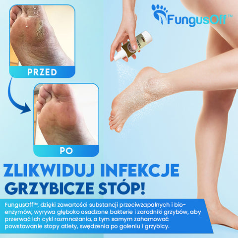 FungusOff™ Szybki i Naturalny Środek do Usuwania  Grzybicy Stopa