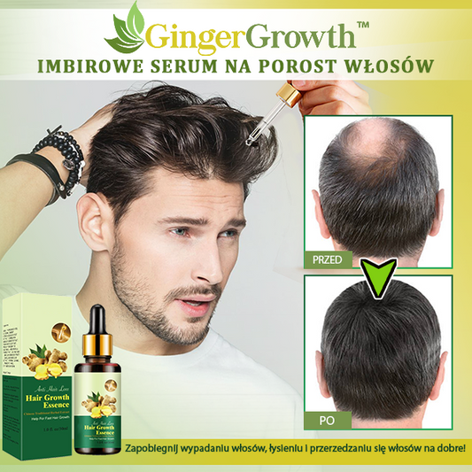 GingerGrowth™ Imbirowe Serum na Porost Włosów