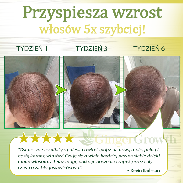 Zdobądź 3x GingerGrowth™ Imbirowe Serum na Porost Włosów za 70% zniżki