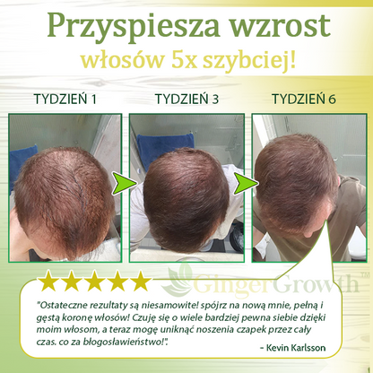 Zdobądź 3x GingerGrowth™ Imbirowe Serum na Porost Włosów za 70% zniżki