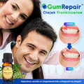 GumRepair™ Olejek Frankincense