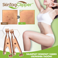 SkinTagClipper™
