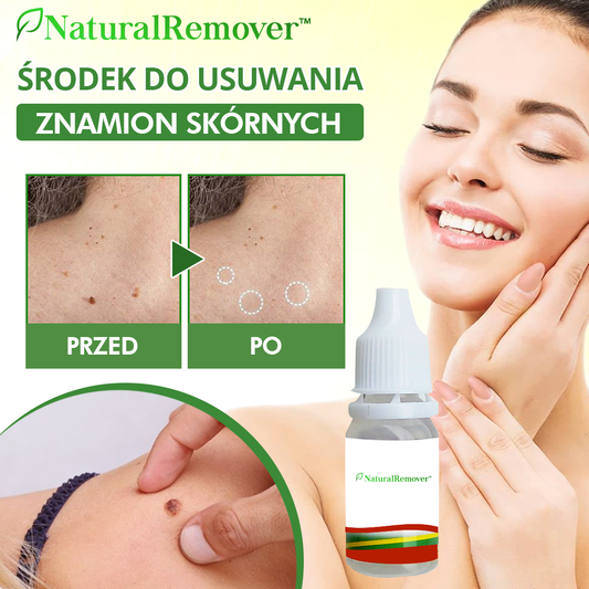 NaturalRemover™ Środek do Usuwania Znamion Skórnych