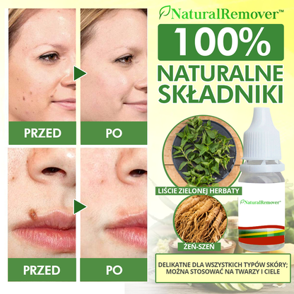 NaturalRemover™ Środek do Usuwania Znamion Skórnych