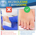 ToePerfect™ Korektor Palców Stóp